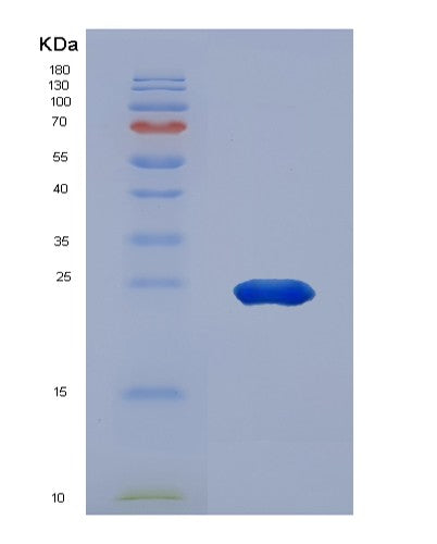 SDS-PAGE analysis of Human HSPA5 (Endoplasmic Reticulum Chaperone Bip) - Recombinant Protein, showing >95% purity under 15% SDS-PAGE (Reduced)