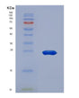 SDS-PAGE analysis of Human HSPA5 (Endoplasmic Reticulum Chaperone Bip) - Recombinant Protein, showing >95% purity under 15% SDS-PAGE (Reduced)