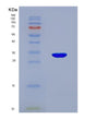 SDS-PAGE analysis of Human UMPS (Uridine 5'-Monophosphate Synthase) - Recombinant Protein, showing >95% purity under 15% SDS-PAGE (Reduced)