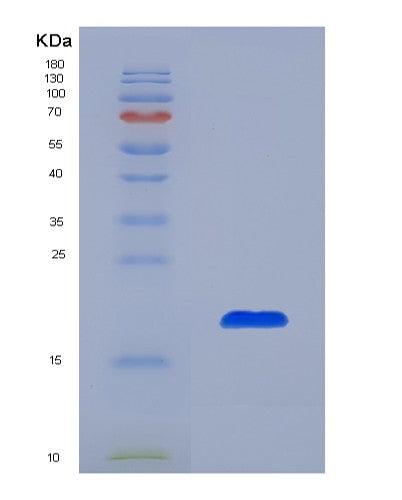 SDS-PAGE analysis of Mouse Crbn (Protein Cereblon) - Recombinant Protein, showing >90% purity under 15% SDS-PAGE (Reduced)