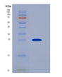SDS-PAGE analysis of Human PSG1 (Pregnancy-Specific Beta-1-Glycoprotein 1) - Recombinant Protein, showing >85% purity under 15% SDS-PAGE (Reduced)