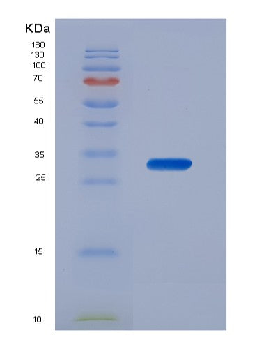 SDS-PAGE analysis of Human CDK4 (Cyclin-Dependent Kinase 4) - Recombinant Protein, showing >90% purity under 15% SDS-PAGE (Reduced)