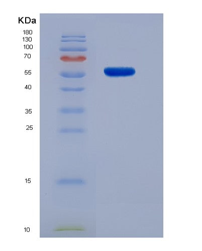 SDS-PAGE analysis of Human PCNA (Proliferating Cell Nuclear Antigen) - Recombinant Protein, showing >95% purity under 15% SDS-PAGE (Reduced)