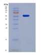 SDS-PAGE analysis of Human PCNA (Proliferating Cell Nuclear Antigen) - Recombinant Protein, showing >95% purity under 15% SDS-PAGE (Reduced)