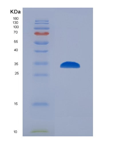 SDS-PAGE analysis of Human IMPDH2 (Inosine-5'-Monophosphate Dehydrogenase 2) - Recombinant Protein, showing >95% purity under 15% SDS-PAGE (Reduced)