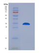 SDS-PAGE analysis of Human IMPDH2 (Inosine-5'-Monophosphate Dehydrogenase 2) - Recombinant Protein, showing >95% purity under 15% SDS-PAGE (Reduced)
