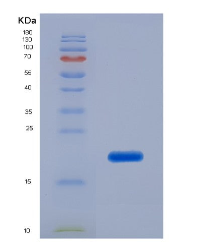 SDS-PAGE analysis of Human PIP (Prolactin-Inducible Protein) - Recombinant Protein, showing >95% purity under 15% SDS-PAGE (Reduced)