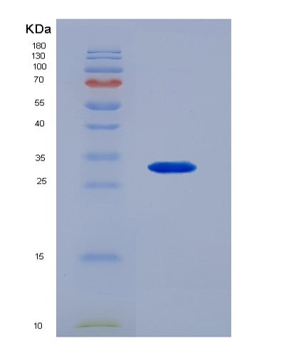SDS-PAGE analysis of Human FCGR2A (Low Affinity Immunoglobulin Gamma Fc Region Receptor Ii-A) - Recombinant Protein, showing >95% purity under 15% SDS-PAGE (Reduced)