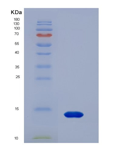 SDS-PAGE analysis of Human ANXA3 (Annexin A3) - Recombinant Protein, showing >90% purity under 15% SDS-PAGE (Reduced)