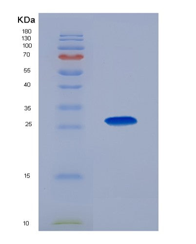 SDS-PAGE analysis of Human CKMT1A (Creatine Kinase U-Type, Mitochondrial) - Recombinant Protein, showing >85% purity under 15% SDS-PAGE (Reduced)