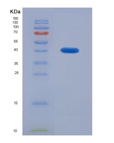 SDS-PAGE analysis of Human BMP2 (Bone Morphogenetic Protein 2) - Recombinant Protein, showing >95% purity under 15% SDS-PAGE (Reduced)