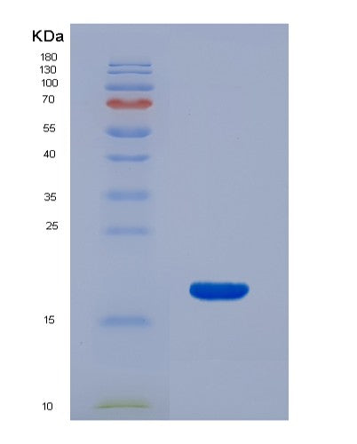 SDS-PAGE analysis of Human RNASE3 (Eosinophil Cationic Protein) - Recombinant Protein, showing >90% purity under 15% SDS-PAGE (Reduced)