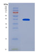 SDS-PAGE analysis of Human UNG (Uracil-Dna Glycosylase) - Recombinant Protein, showing >85% purity under 15% SDS-PAGE (Reduced)