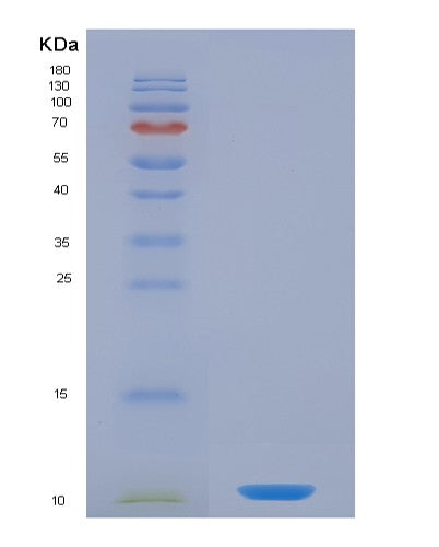 SDS-PAGE analysis of Human CCL5 (C-C Motif Chemokine 5) - Recombinant Protein, showing >90% purity under 15% SDS-PAGE (Reduced)