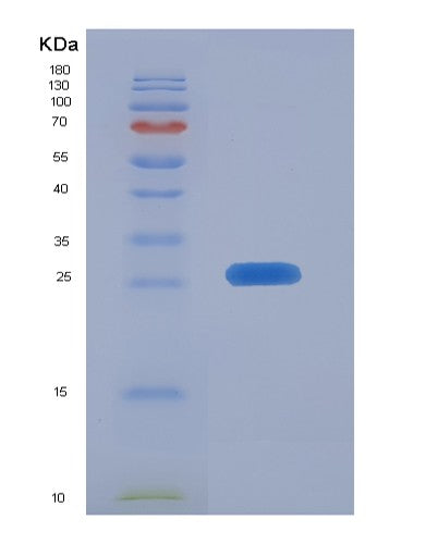 SDS-PAGE analysis of Human ICAM2 (Intercellular Adhesion Molecule 2) - Recombinant Protein, showing >95% purity under 15% SDS-PAGE (Reduced)