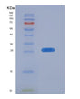 SDS-PAGE analysis of Human ICAM2 (Intercellular Adhesion Molecule 2) - Recombinant Protein, showing >95% purity under 15% SDS-PAGE (Reduced)