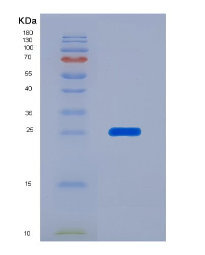 SDS-PAGE analysis of Human EEF2 (Elongation Factor 2) - Recombinant Protein, showing >95% purity under 15% SDS-PAGE (Reduced)