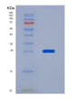 SDS-PAGE analysis of Human EEF2 (Elongation Factor 2) - Recombinant Protein, showing >95% purity under 15% SDS-PAGE (Reduced)