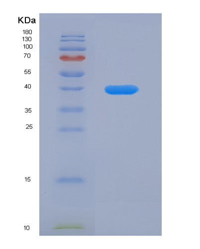 SDS-PAGE analysis of Human KRT5 (Keratin, Type Ii Cytoskeletal 5) - Recombinant Protein, showing >95% purity under 15% SDS-PAGE (Reduced)