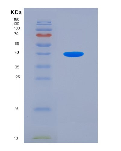 SDS-PAGE analysis of Human ALAD (Delta-Aminolevulinic Acid Dehydratase) - Recombinant Protein, showing >85% purity under 15% SDS-PAGE (Reduced)