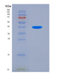 SDS-PAGE analysis of Human ALAD (Delta-Aminolevulinic Acid Dehydratase) - Recombinant Protein, showing >85% purity under 15% SDS-PAGE (Reduced)