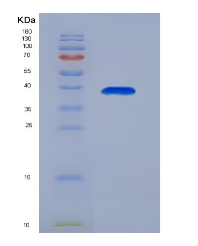 SDS-PAGE analysis of Human ANXA8 (Annexin A8) - Recombinant Protein, showing >95% purity under 15% SDS-PAGE (Reduced)