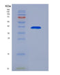 SDS-PAGE analysis of Human ANXA8 (Annexin A8) - Recombinant Protein, showing >95% purity under 15% SDS-PAGE (Reduced)