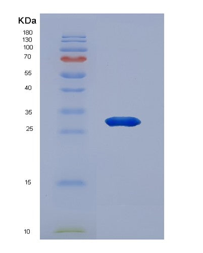 SDS-PAGE analysis of Human HSD17B1 (17-Beta-Hydroxysteroid Dehydrogenase Type 1) - Recombinant Protein, showing >95% purity under 15% SDS-PAGE (Reduced)
