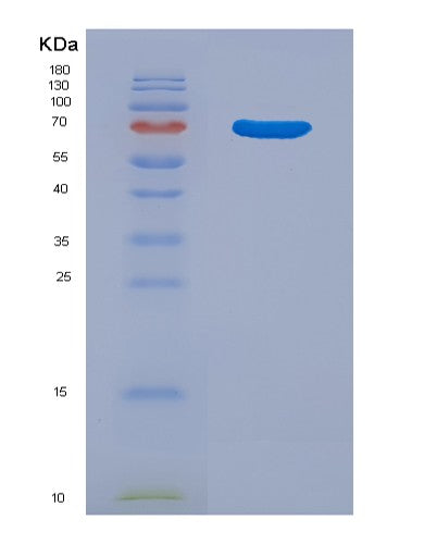 SDS-PAGE analysis of Human CTSE (Cathepsin E) - Recombinant Protein, showing >90% purity under 15% SDS-PAGE (Reduced)