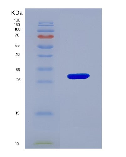 SDS-PAGE analysis of Human KLF5 (Krueppel-Like Factor 5) - Recombinant Protein, showing >90% purity under 15% SDS-PAGE (Reduced)