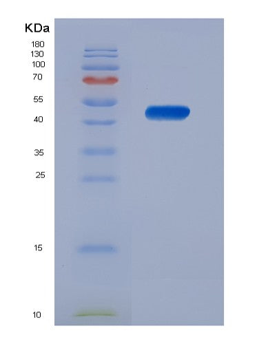 SDS-PAGE analysis of Human NCF1 (Neutrophil Cytosol Factor 1) - Recombinant Protein, showing >85% purity under 15% SDS-PAGE (Reduced)