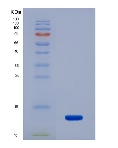 SDS-PAGE analysis of Human PKM (Pyruvate Kinase Pkm) - Recombinant Protein, showing >90% purity under 15% SDS-PAGE (Reduced)