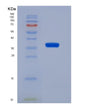 SDS-PAGE analysis of Human VCAN (Versican Core Protein) - Recombinant Protein, showing >90% purity under 15% SDS-PAGE (Reduced)