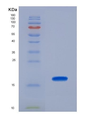 SDS-PAGE analysis of Human DARS1 (Aspartate--Trna Ligase, Cytoplasmic) - Recombinant Protein, showing >95% purity under 15% SDS-PAGE (Reduced)