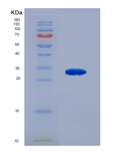 SDS-PAGE analysis of Human ARSA (Arylsulfatase A) - Recombinant Protein, showing >85% purity under 15% SDS-PAGE (Reduced)