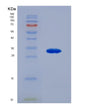 SDS-PAGE analysis of Human ARSA (Arylsulfatase A) - Recombinant Protein, showing >85% purity under 15% SDS-PAGE (Reduced)