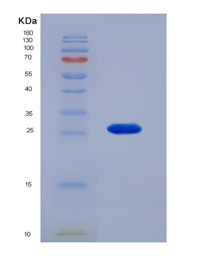 SDS-PAGE analysis of Human FOLR1 (Folate Receptor Alpha) - Recombinant Protein, showing >85% purity under 15% SDS-PAGE (Reduced)
