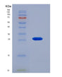 SDS-PAGE analysis of Human FOLR1 (Folate Receptor Alpha) - Recombinant Protein, showing >85% purity under 15% SDS-PAGE (Reduced)