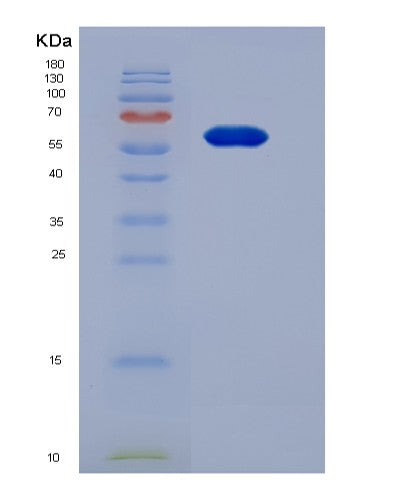 SDS-PAGE analysis of Human VAV1 (Proto-Oncogene Vav) - Recombinant Protein, showing >95% purity under 15% SDS-PAGE (Reduced)