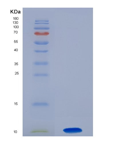 SDS-PAGE analysis of Human CSF2RA (Granulocyte-Macrophage Colony-Stimulating Factor Receptor Subunit Alpha) - Recombinant Protein, showing >90% purity under 15% SDS-PAGE (Reduced)