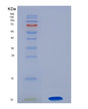 SDS-PAGE analysis of Human CSF2RA (Granulocyte-Macrophage Colony-Stimulating Factor Receptor Subunit Alpha) - Recombinant Protein, showing >90% purity under 15% SDS-PAGE (Reduced)