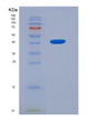 SDS-PAGE analysis of Human AREG (Amphiregulin) - Recombinant Protein, showing >90% purity under 15% SDS-PAGE (Reduced)