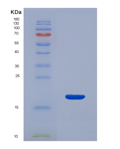 SDS-PAGE analysis of Human CD46 (Membrane Cofactor Protein) - Recombinant Protein, showing >85% purity under 15% SDS-PAGE (Reduced)