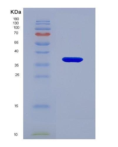 SDS-PAGE analysis of Human SRD5A2 (3-Oxo-5-Alpha-Steroid 4-Dehydrogenase 2) - Recombinant Protein, showing >90% purity under 15% SDS-PAGE (Reduced)