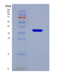 SDS-PAGE analysis of Human SRD5A2 (3-Oxo-5-Alpha-Steroid 4-Dehydrogenase 2) - Recombinant Protein, showing >90% purity under 15% SDS-PAGE (Reduced)