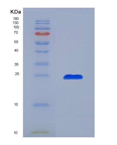SDS-PAGE analysis of Human IGLL1 (Immunoglobulin Lambda-Like Polypeptide 1) - Recombinant Protein, showing >95% purity under 15% SDS-PAGE (Reduced)