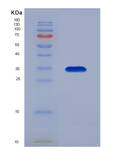 SDS-PAGE analysis of Human CBR1 (Carbonyl Reductase [Nadph] 1) - Recombinant Protein, showing >90% purity under 15% SDS-PAGE (Reduced)