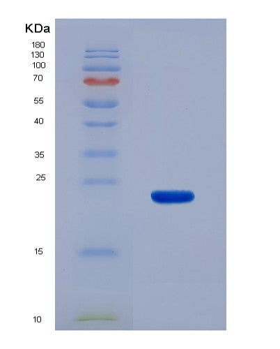 SDS-PAGE analysis of Human ACADS (Short-Chain Specific Acyl-Coa Dehydrogenase, Mitochondrial) - Recombinant Protein, showing >85% purity under 15% SDS-PAGE (Reduced)