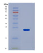 SDS-PAGE analysis of Human ACADS (Short-Chain Specific Acyl-Coa Dehydrogenase, Mitochondrial) - Recombinant Protein, showing >85% purity under 15% SDS-PAGE (Reduced)