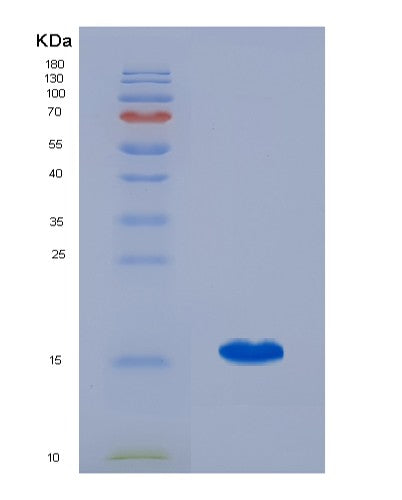 SDS-PAGE analysis of Human FABP5 (Fatty Acid-Binding Protein 5) - Recombinant Protein, showing >90% purity under 15% SDS-PAGE (Reduced)